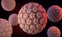 کنفرانس علمی یکروزه شوک و انواع درمان آن و HPV در زنان